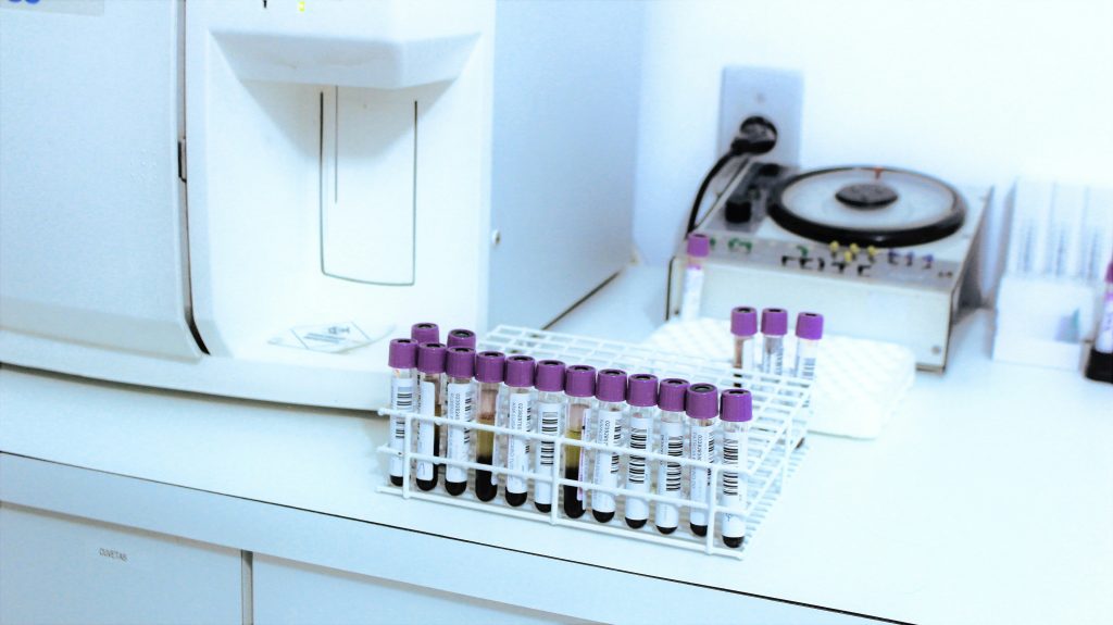 Laboratory blood test samples used for a functional nutrition blood analysis and health report