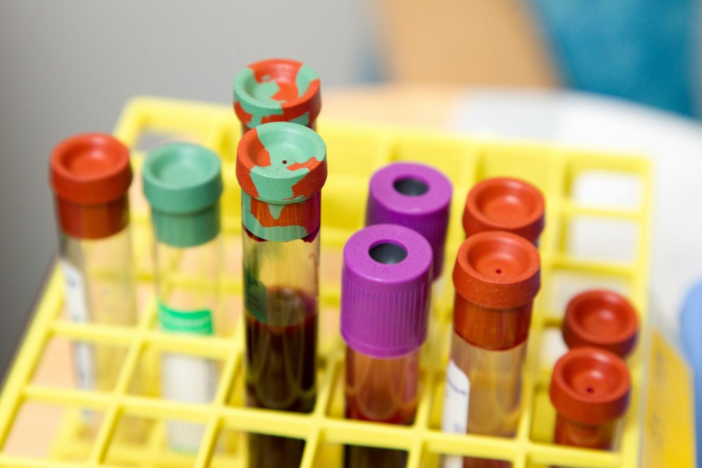 Personalized functional nutrition blood analysis lab test tubes for root cause health assessment